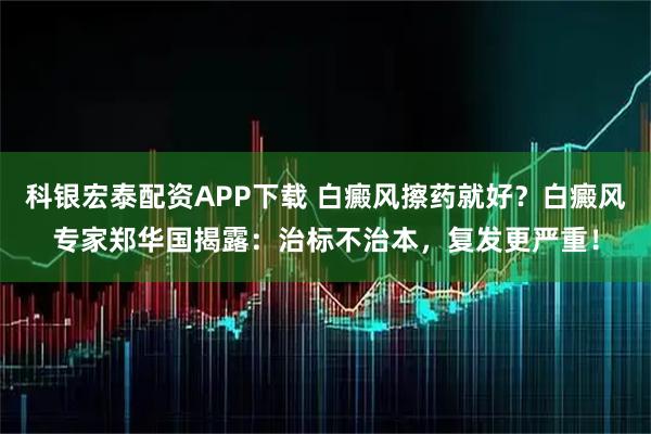 科银宏泰配资APP下载 白癜风擦药就好？白癜风专家郑华国揭露：治标不治本，复发更严重！